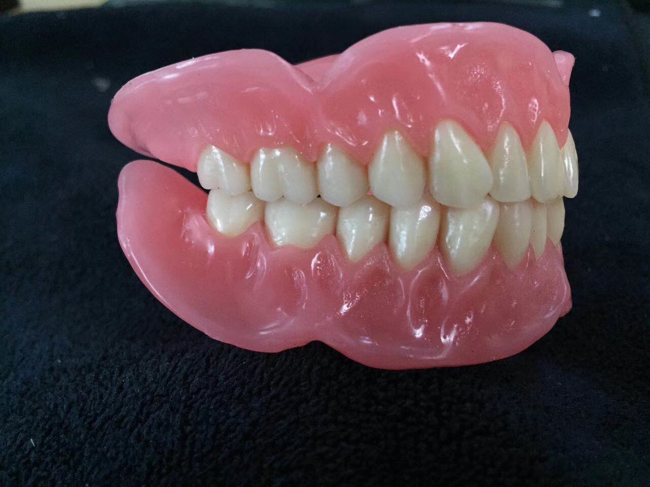 Full upper and full lower dentures